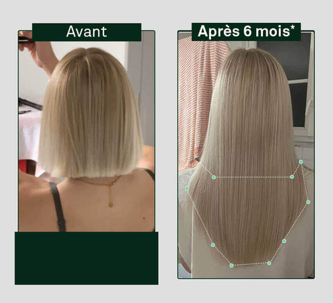 Hair Density Growth and Strengthening (3 months)